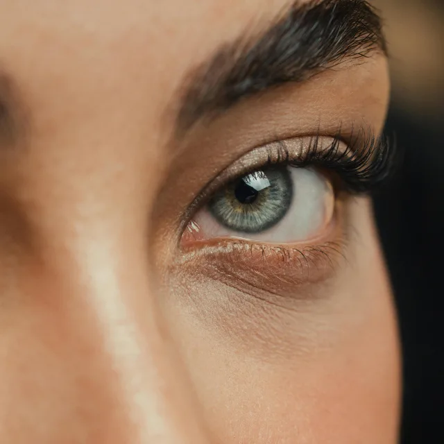 Upper Eyelid Lift Surgery London